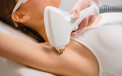 Depilacja laserowa laserem EPIL DIODA 3D + RF. Innowacja w usuwaniu owłosienia